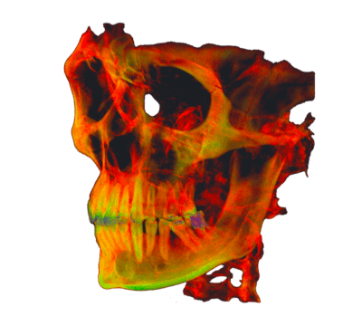 CT Reconstruction Outcome use cases meshlib sdk