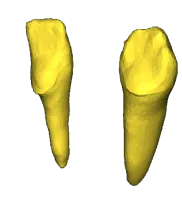Two separated tooth fragments before ICP alignment