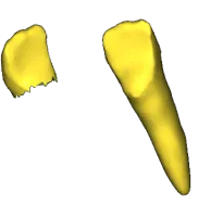 Detached tooth chip beside the main mesh before ICP alignment