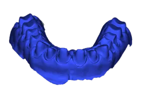 Dental model created with mesh offset
