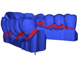 Dental model