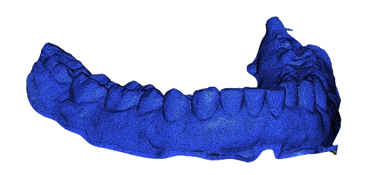 3D jaw mesh after simplification – reduced to 84,000 triangles