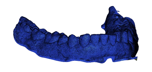 3D jaw mesh before simplification – 414,000 triangles