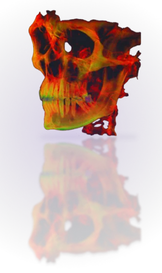 CT Scanning