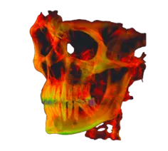 Colorful CT volume rendering of a human skull used in scanner software