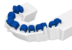 Dental arch model with blue caps for a crown and aligner workflow