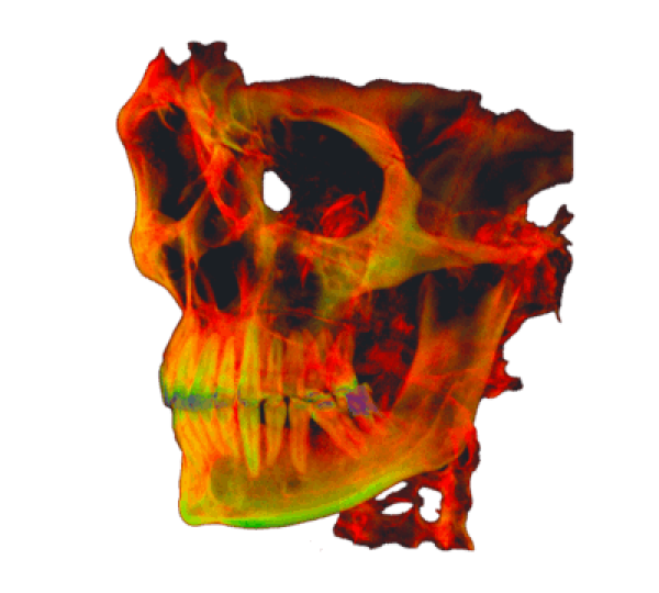 CT Scanner Software illustration