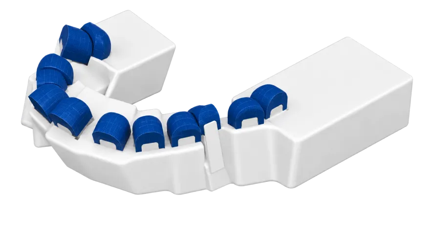 White dental arch model with blue caps fitted on the teeth