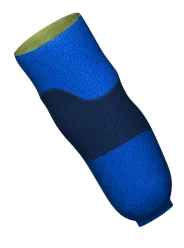Hollow patient-specific implant model built from CT or MRI scan data