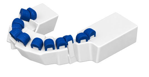 Jaw scan with dental crowns 3D model in dental software